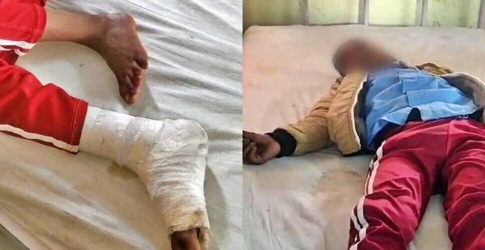 हरदोई में शिक्षक द्वारा छात्र की पिटाई, मामला दर्ज