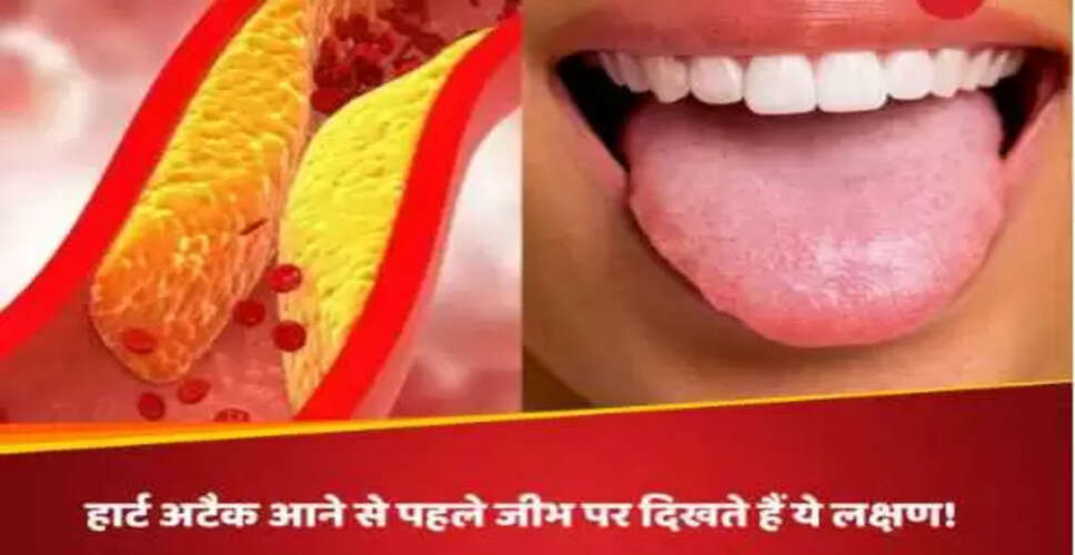 जीभ पर हाई कोलेस्ट्रॉल के 4 लक्षण: जानें कैसे पहचानें