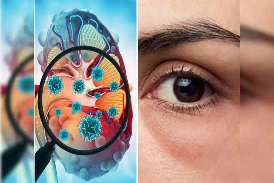 किडनी स्वास्थ्य के संकेत: आँखों में बदलाव का ध्यान रखें