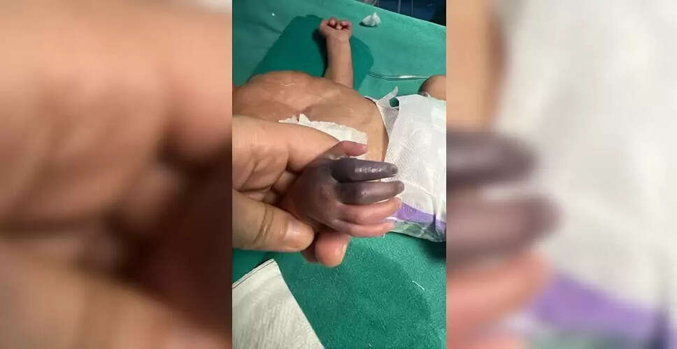 ग्रेटर नोएडा में नवजात बच्ची के इलाज में लापरवाही का मामला