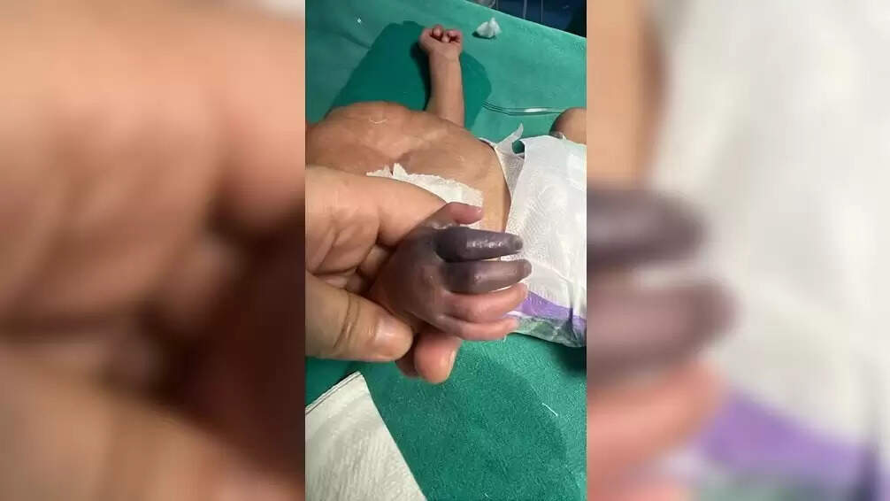 ग्रेटर नोएडा में नवजात बच्ची के इलाज में लापरवाही का मामला