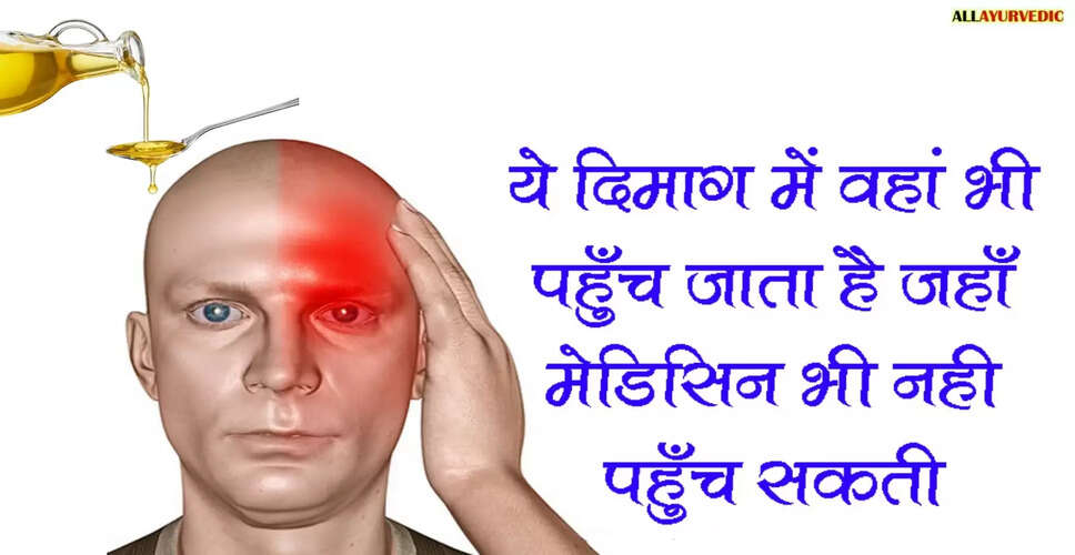 माइग्रेन के घरेलू उपचार: दर्द से राहत पाने के उपाय