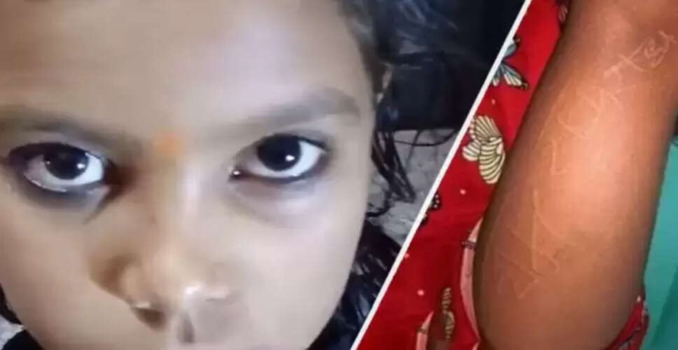 हरदोई में बच्ची के शरीर पर उभरे ईश्वरीय नाम, रहस्य बना हुआ है