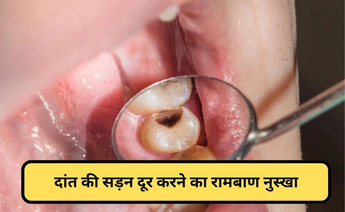 दांतों की कैविटी से छुटकारा पाने के घरेलू उपाय