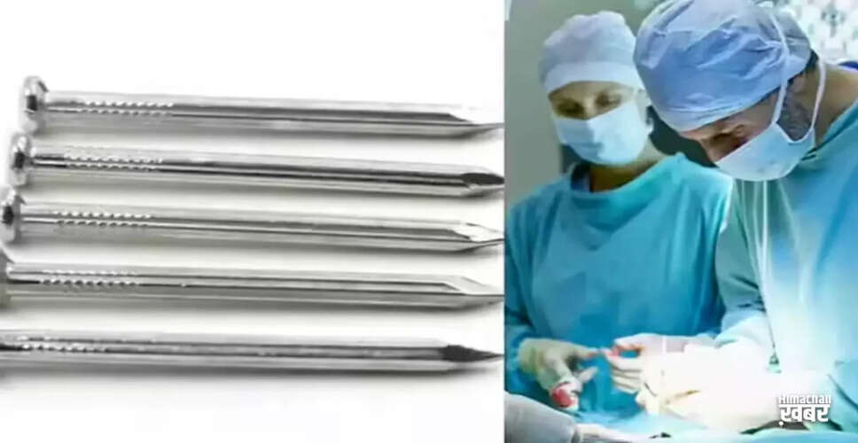 यूपी में युवक ने सिर में ठोकी कील, जटिल सर्जरी से बची जान