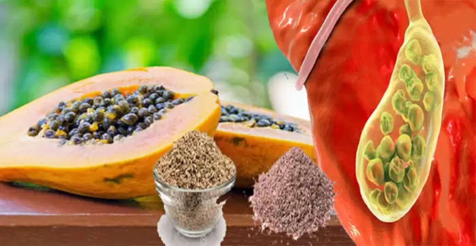 घरेलू उपायों से पथरी का प्रभावी इलाज