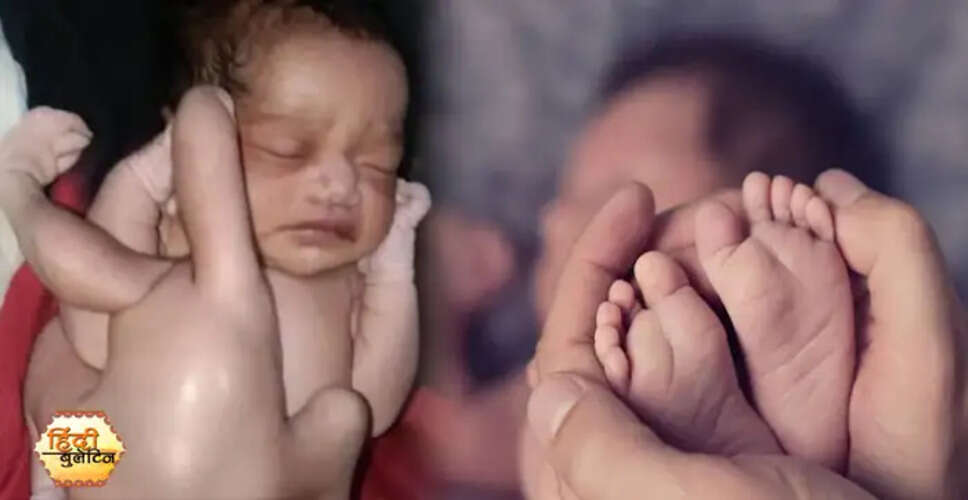 उत्तर प्रदेश में चार हाथ और चार पैर वाले बच्चे का जन्म