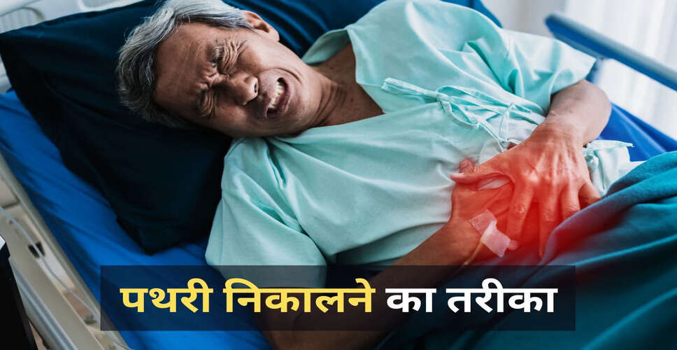 पथरी के घरेलू उपचार: राजीव दीक्षित के नुस्खे