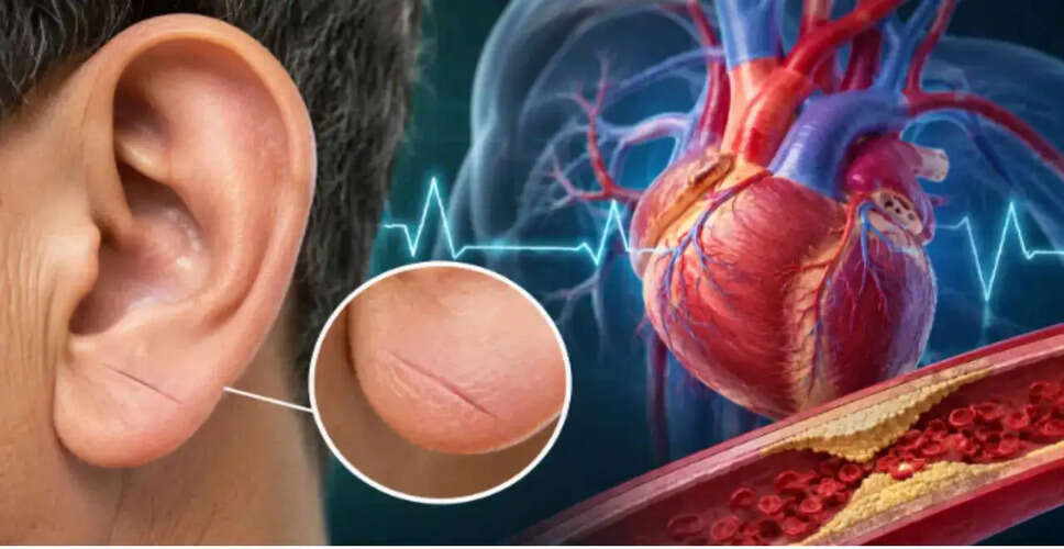 कान के लोब में झुर्री: दिल की बीमारी का संकेत
