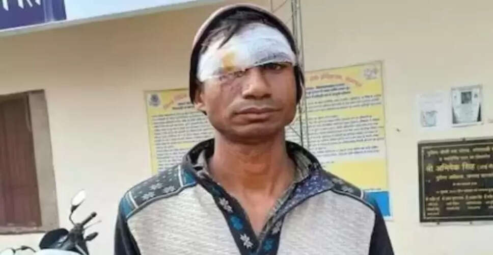 यूपी में पत्नी ने मोबाइल देने से मना करने पर पति की आंख में घोंपी कैंची