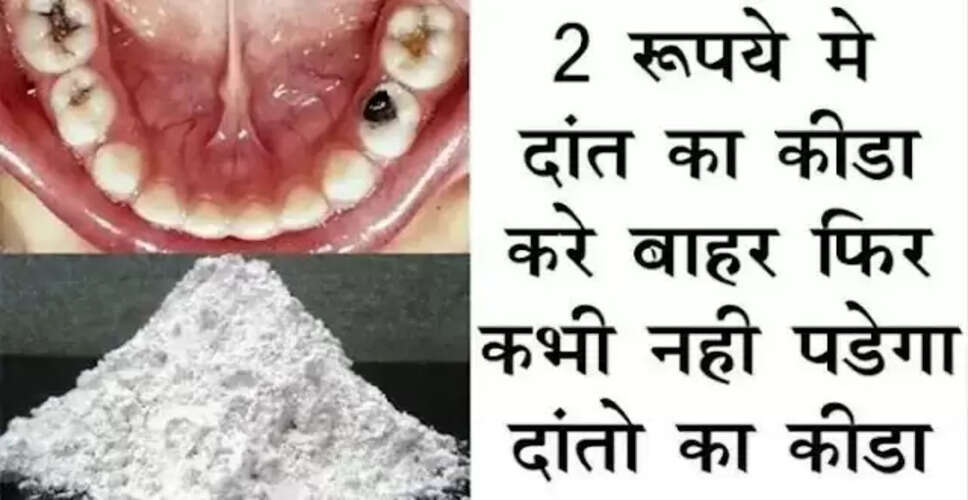 दांतों के कीड़ों को खत्म करने का सरल और प्रभावी उपाय