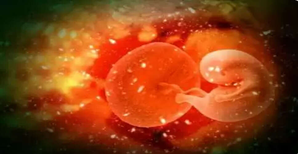 चौदह दिन के बच्चे से निकले तीन भ्रूण, बीएचयू के डॉक्टरों ने किया चमत्कार