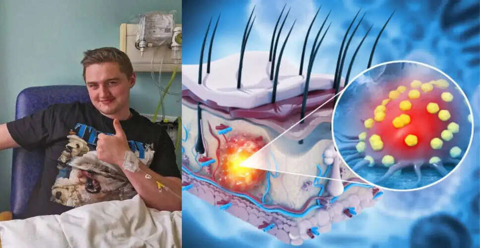 फिनियन गार्बट की कैंसर से जंग: पत्नी और बच्चे के लिए समर्थन की अपील