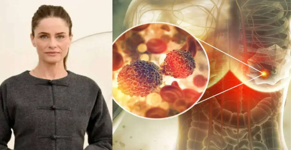 अमांडा पीट का कैंसर निदान: महिलाओं के लिए प्रारंभिक स्क्रीनिंग का महत्व