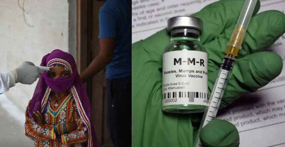 बांग्लादेश में खसरे का संकट: बढ़ते मामलों पर चिंता