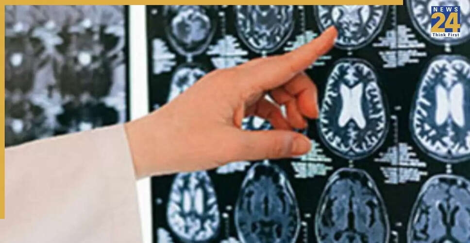केरल में 'ब्रेन-ईटिंग अमीबा' से 19 लोगों की मौत, स्वास्थ्य विभाग सतर्क