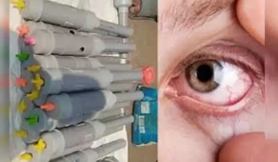 दिवाली पर देसी कार्बाइड गन से बच्चों में भारी चोटें, जानें पूरा मामला