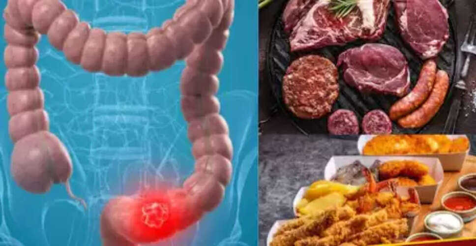 कोलोन कैंसर: जानें लक्षण, कारण और बचाव के उपाय