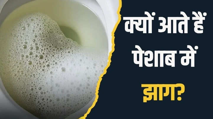 पेशाब में झाग: जानें इसके कारण और उपाय