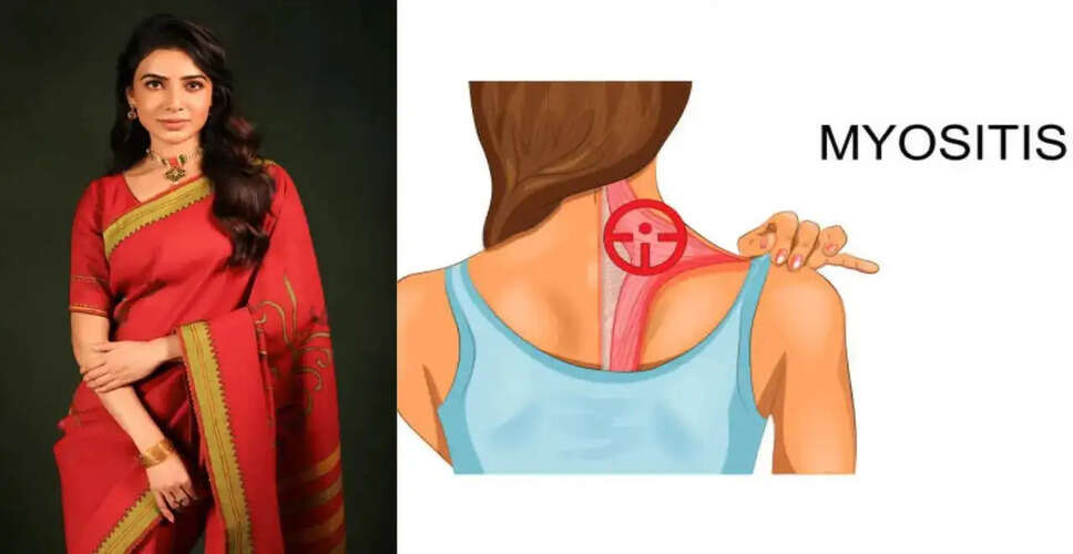 सामंथा रुथ प्रभु की गर्भावस्था: ऑटोइम्यून रोगों के साथ मातृत्व की चुनौतियाँ