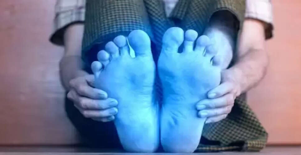 डायबिटीज के मरीजों में सर्दियों में ठंडे हाथ-पैर: जानें कारण और उपाय
