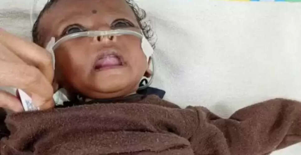 मध्यप्रदेश में अंधविश्वास का शिकार: 3 महीने की बच्ची को गर्म सलाखों से दागा गया