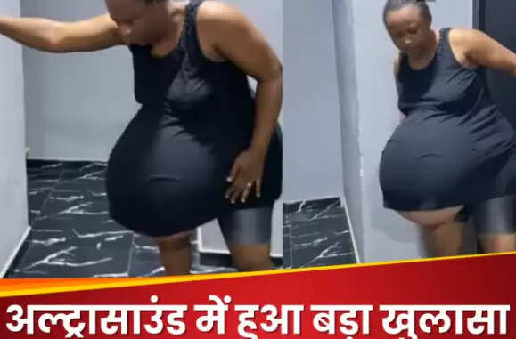महिला के गर्भ में चार बच्चों की अनोखी कहानी वायरल