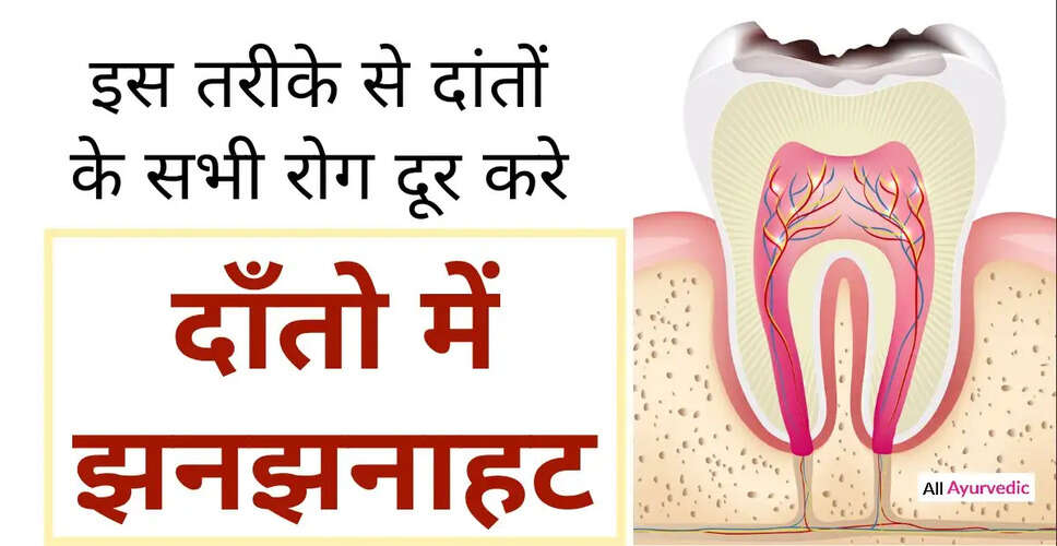 दांत दर्द और मसूड़ों की सूजन: घरेलू उपचार और सावधानियाँ
