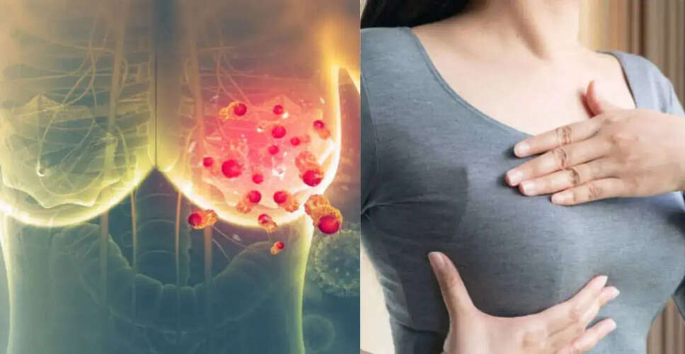 भारत में स्तन कैंसर के मामलों में चिंताजनक वृद्धि