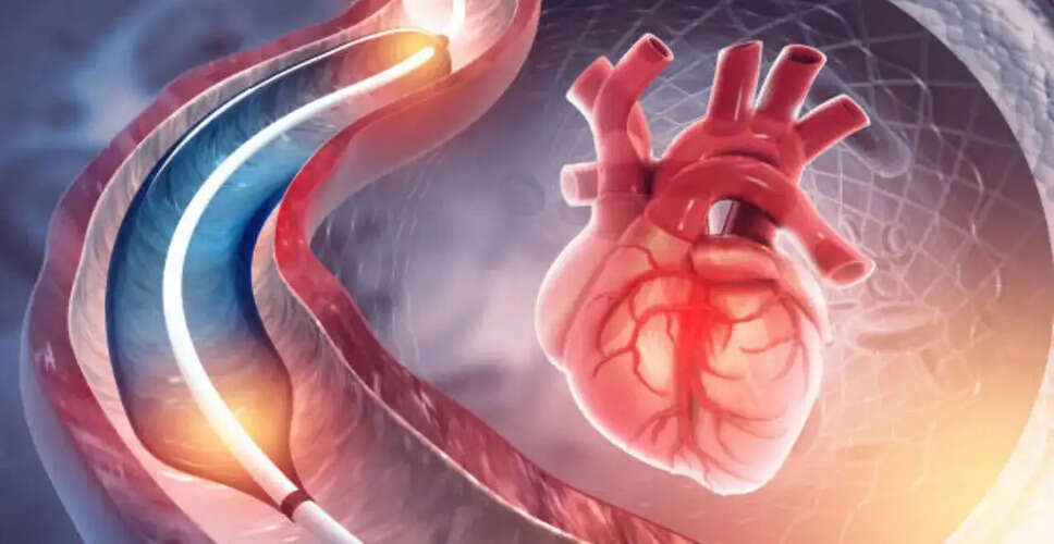 एंजियोग्राफी के बारे में सामान्य भ्रांतियाँ और सच्चाई