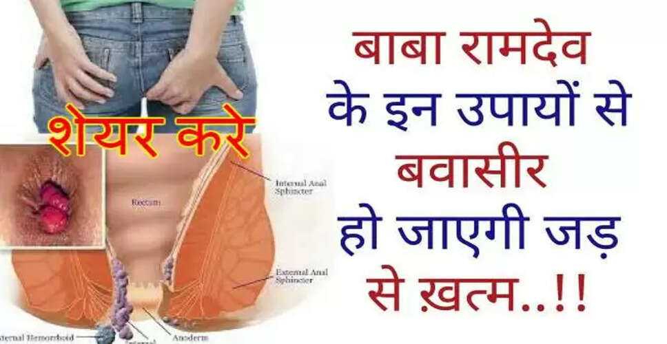बवासीर के घरेलू उपचार: प्राकृतिक तरीके से राहत पाएं