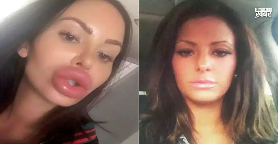 ऑस्ट्रेलिया की नर्स की सर्जरी की लत: 97 लाख रुपये खर्च कर चुकी हैं तारा