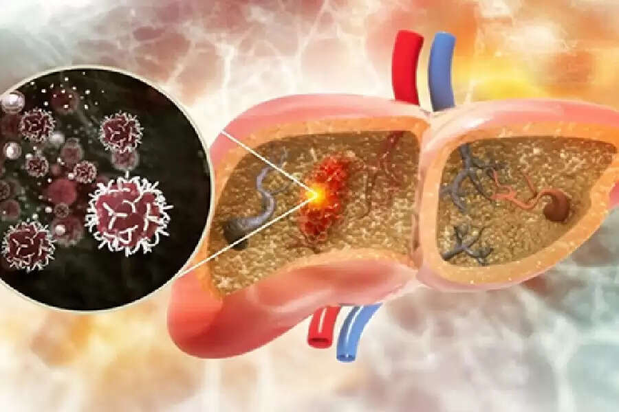लिवर कैंसर के लक्षण: दर्द और अन्य संकेतों पर ध्यान दें