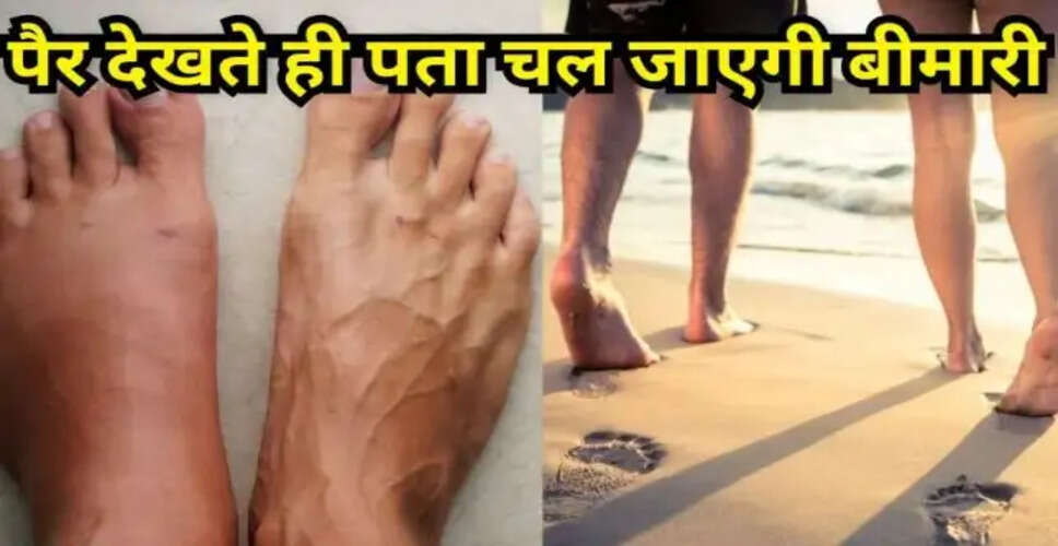 पैरों के लक्षण: स्वास्थ्य समस्याओं का संकेत