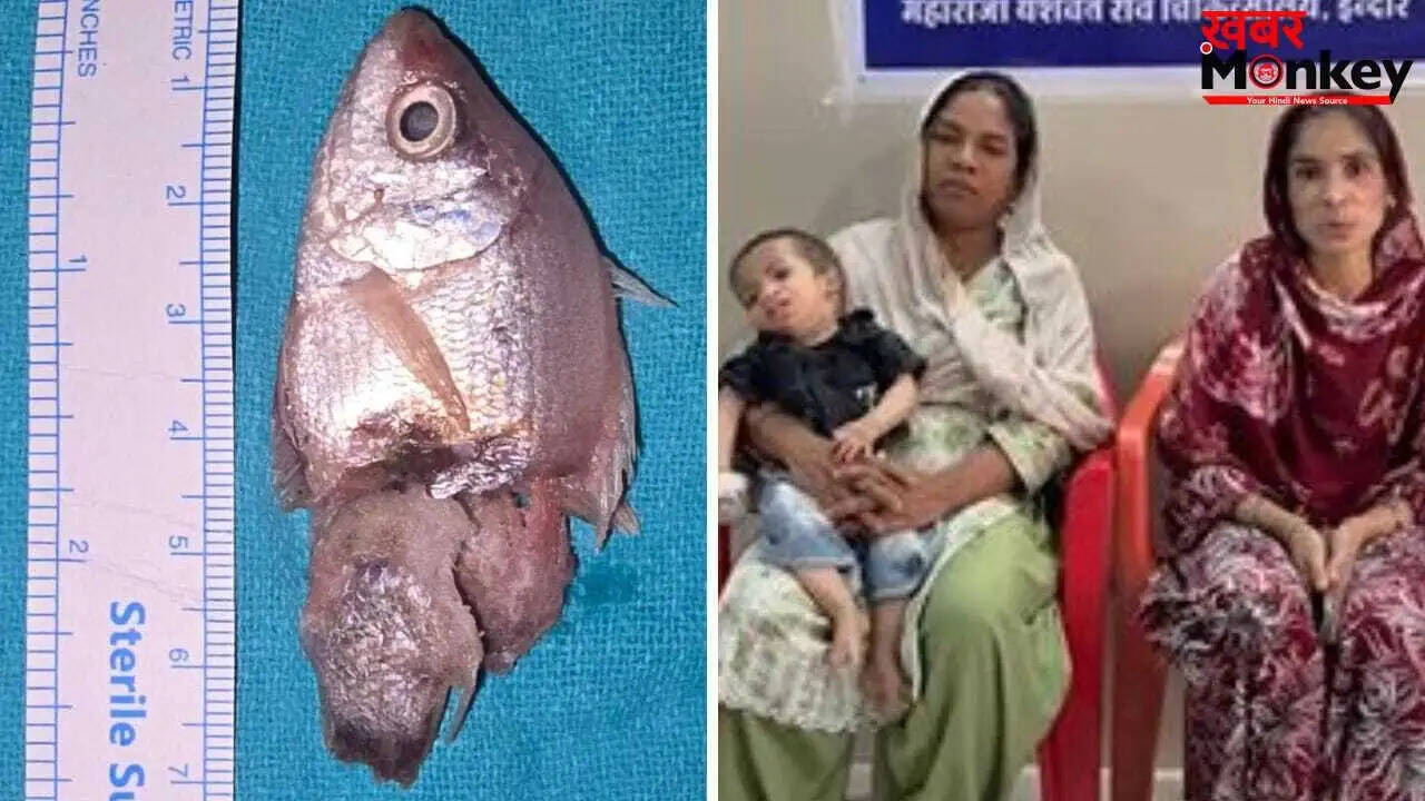 मध्य प्रदेश के अस्पताल में डॉक्टरों ने बचाई एक साल के बच्चे की जान, गले से निकाली जिंदा मछली
