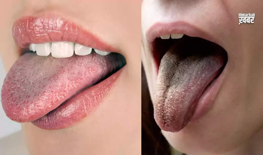 जीभ के रंग से जानें स्वास्थ्य की स्थिति: क्या संकेत देती है आपकी जीभ?