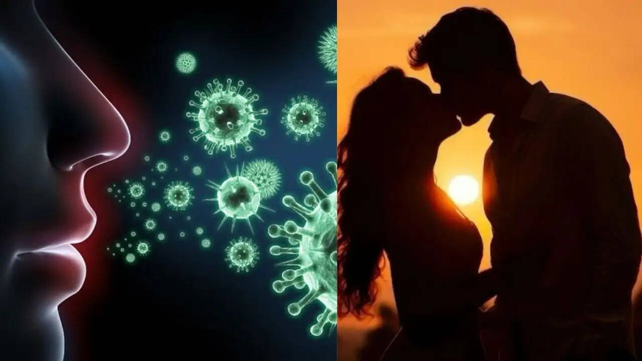 किसिंग डिजीज: जानें इसके फैलने के तरीके और लक्षण