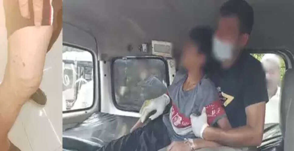 केरल में कुत्ते के काटने से हुई मौतों के बाद रेबीज रोकथाम पर तमिलनाडु ने एडवाइजरी जारी की