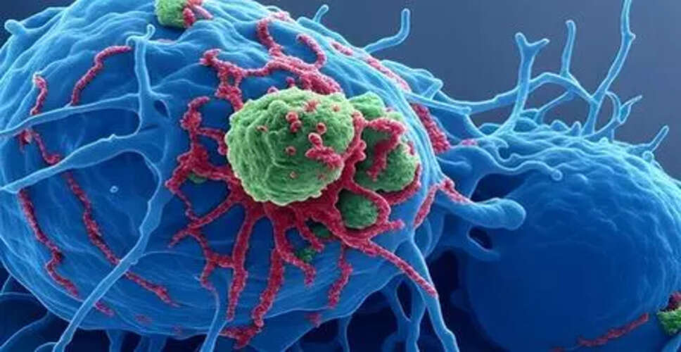 संक्रमणकारी खाद्य पदार्थों का कैंसर से संबंध: नई अध्ययन रिपोर्ट