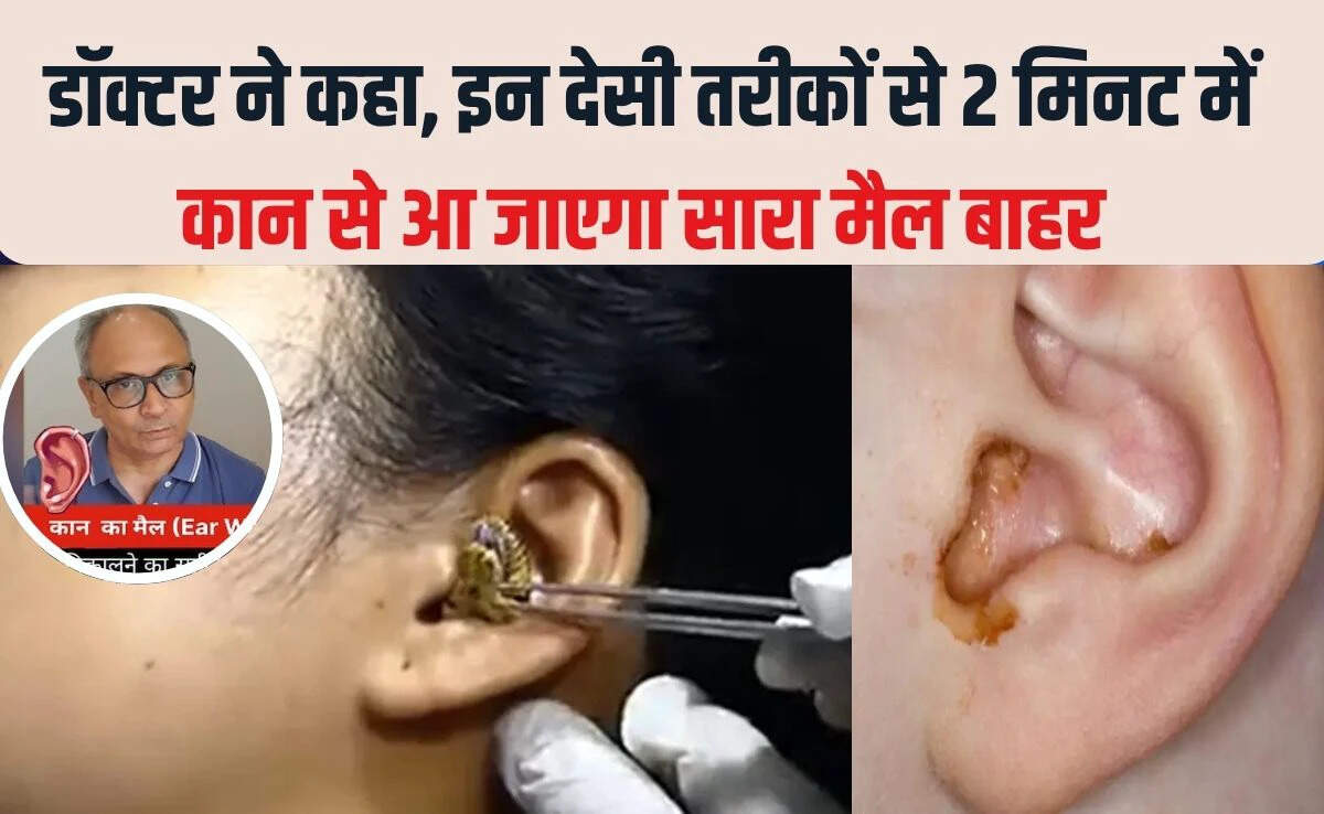 कान के मैल को साफ करने के सरल उपाय