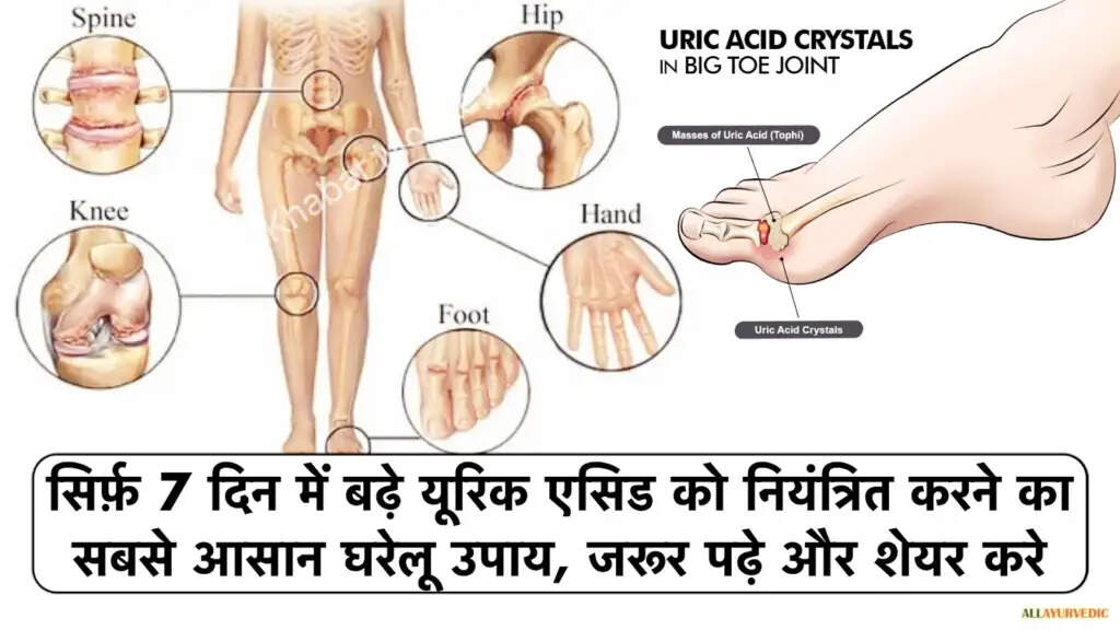 यूरिक एसिड को नियंत्रित करने के प्रभावी घरेलू उपाय