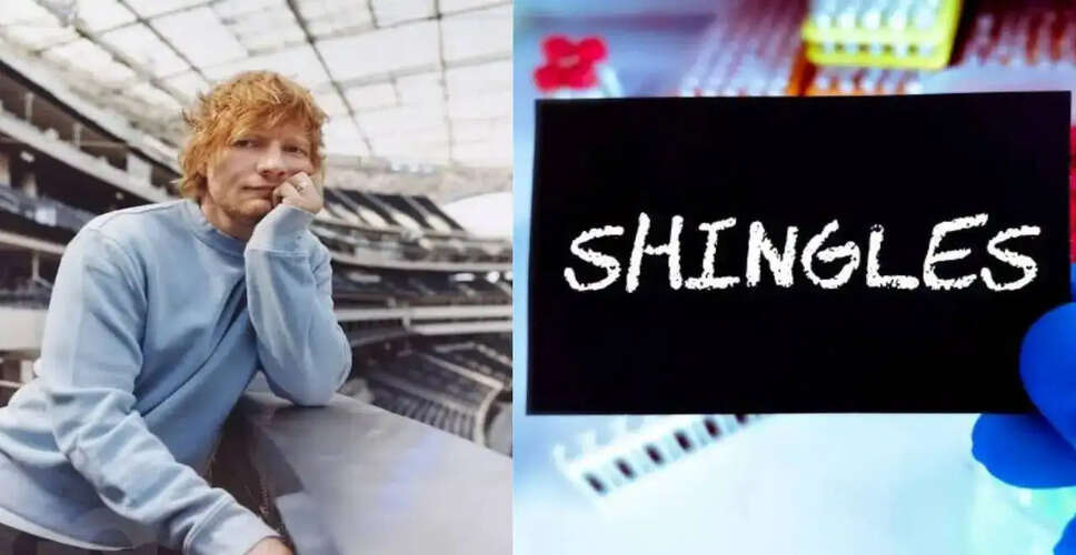 एड शीरन ने शिंगल्स से उबरने का अनुभव साझा किया