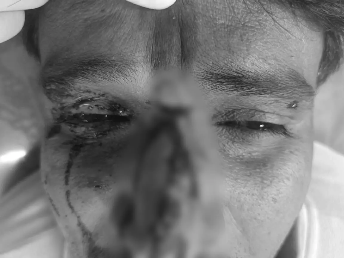 जयपुर में मकर संक्रांति पर पतंगबाजी के दौरान 140 से अधिक लोग घायल