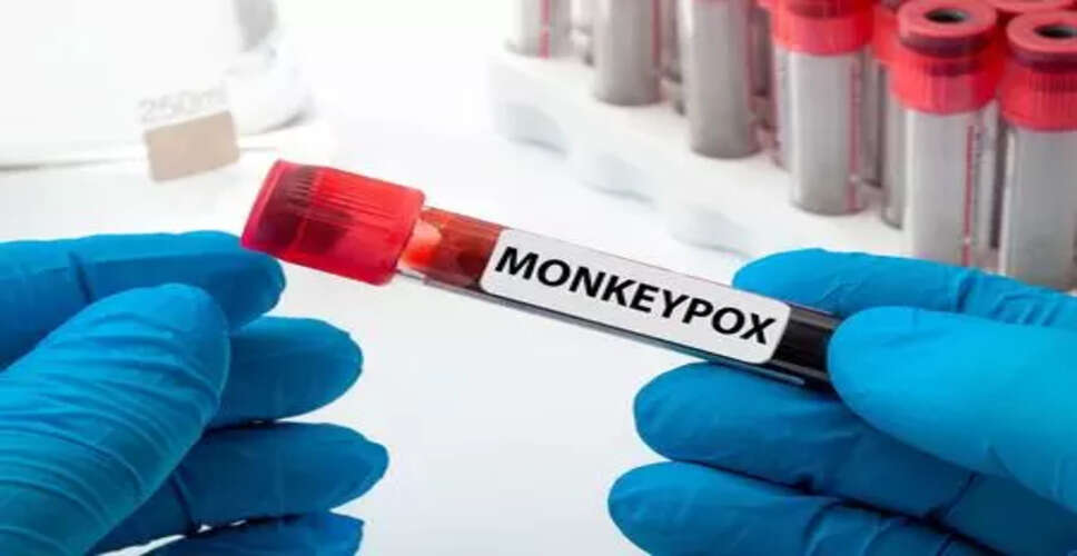 अफ्रीका में mpox महामारी से 1,800 से अधिक मौतें, मामलों की संख्या 150,000 के करीब