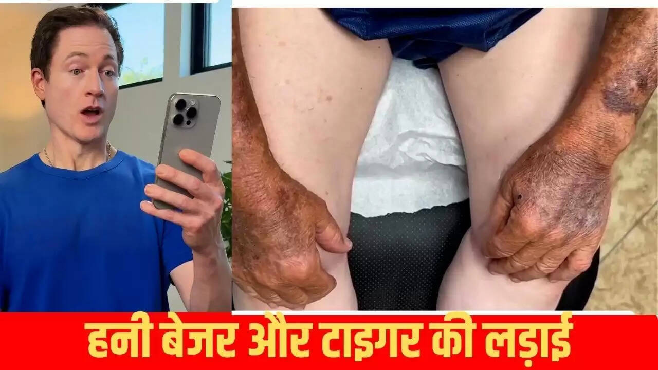 ब्रायन जॉनसन का एंटी-एजिंग राज: सूरज की रोशनी का सही उपयोग