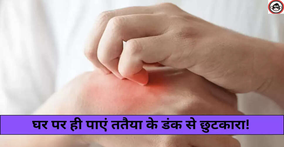 घरेलू उपाय: ततैया के डंक से राहत पाने के लिए सरल नुस्खे