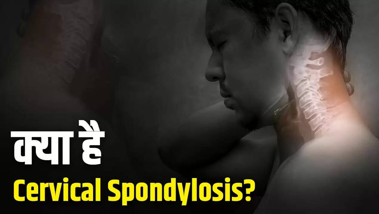 गर्दन के दर्द का कारण: Cervical Spondylosis के लक्षण और उपचार
