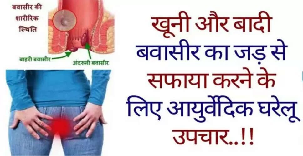 बवासीर के उपचार: आयुर्वेदिक उपाय और घरेलू नुस्खे
