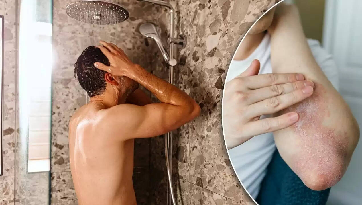 सर्दियों में स्किन की बीमारियों से बचने के लिए नहाने के सही तरीके