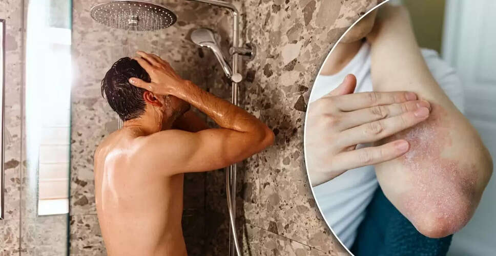 सर्दियों में स्किन की बीमारियों से बचने के लिए नहाने के सही तरीके